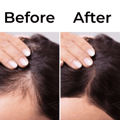 Must Grow Hair Oil For Fast Healthy Hair And Edge Growth.